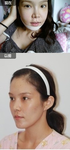 长脸