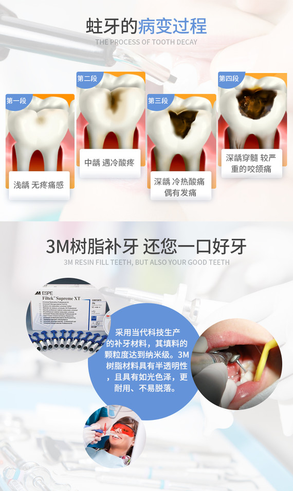 【补牙】【美国3m树脂补牙】美牙固齿 轻松修复龋齿蛀牙牙洞虫牙洞
