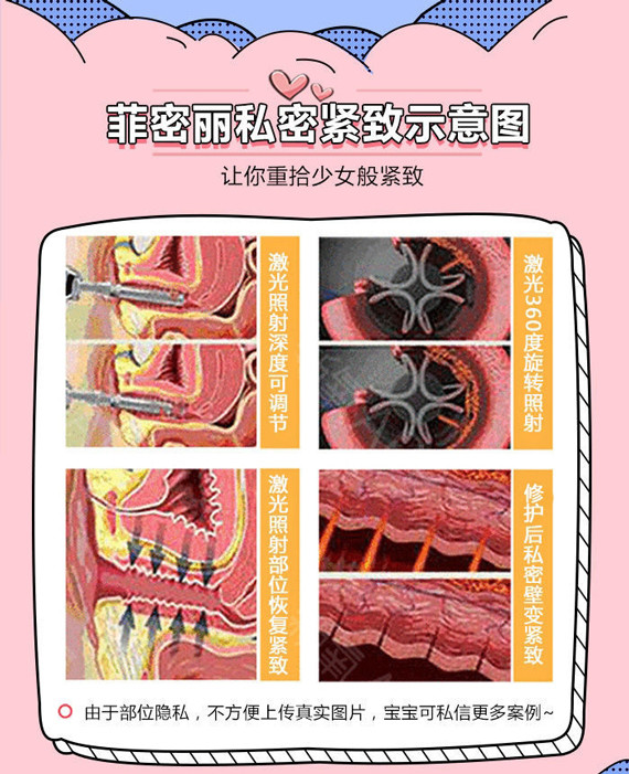 【私密护理】进口菲蜜丽,紧致缩阴,私密漂红,呵护女性健康,做性福女人