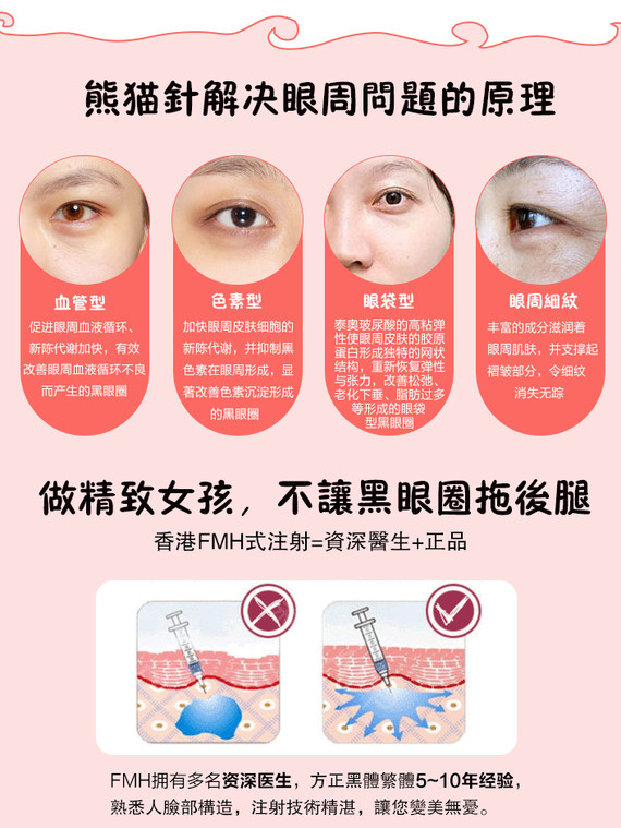 【玻尿酸】泰奥熊猫针 一款专门针对眼部玻尿酸填充 塑形填充泪沟/黑