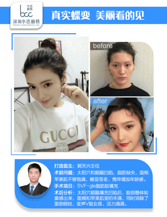 面膜 570_740 竖版 竖屏 gif 动态图 动图
