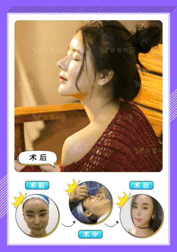 570_813 竖版 竖屏 gif 动态图 动图