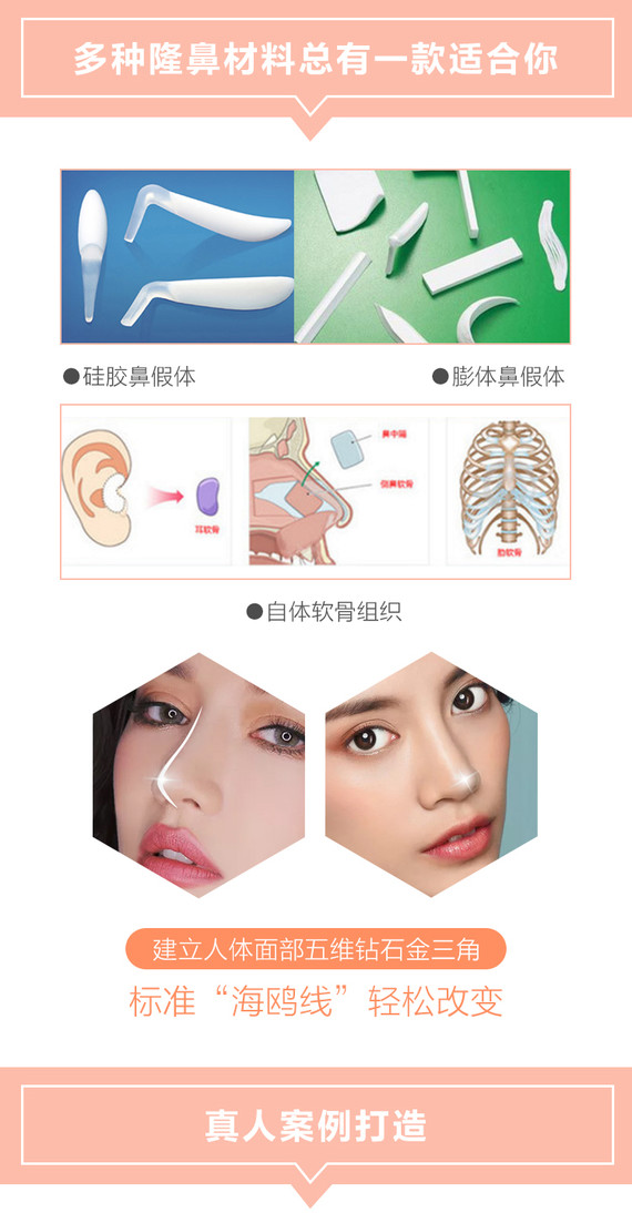 【鼻综合】【贝兹曲线鼻综合】韩式生科/假体隆鼻(万和) 双维定格假体