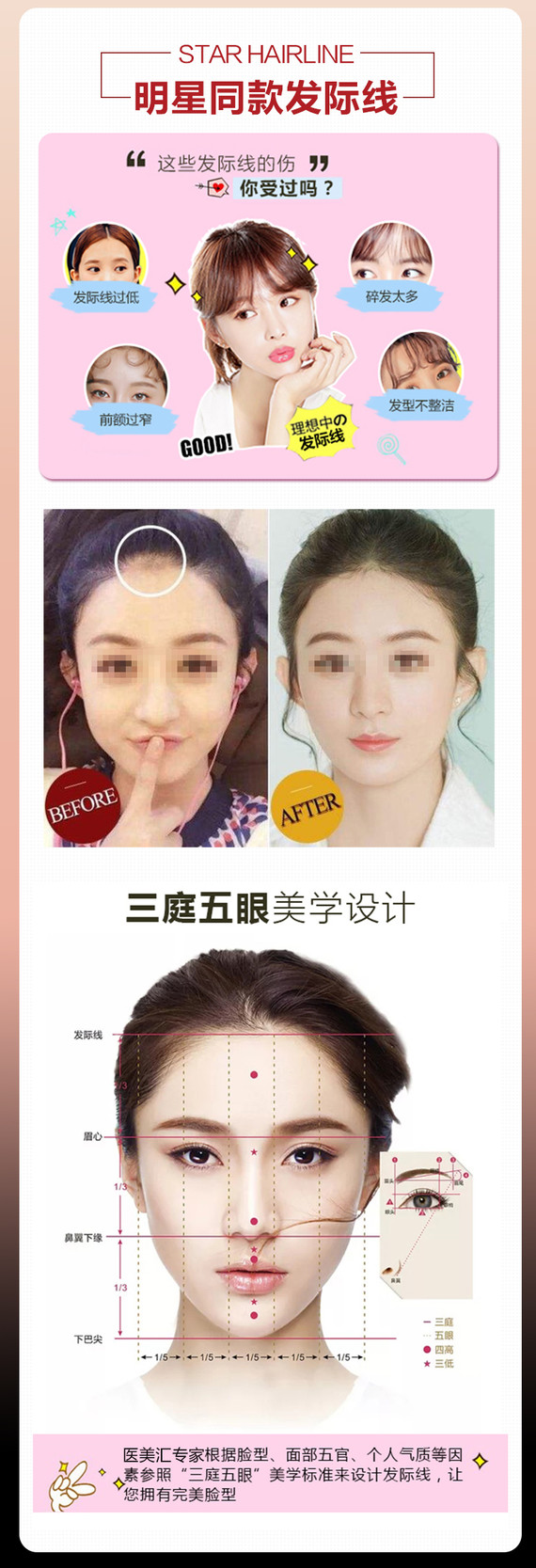 【激光脱毛】脱发际线 6次 ,【冰点无痛发际线】脱毛嫩肤 美白效果 前