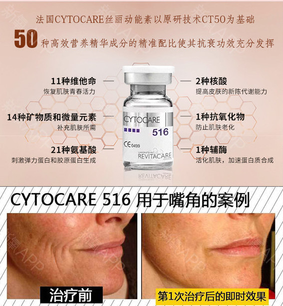 【水光针】丝丽动能素 5ml 法国进口液态拉皮之王"