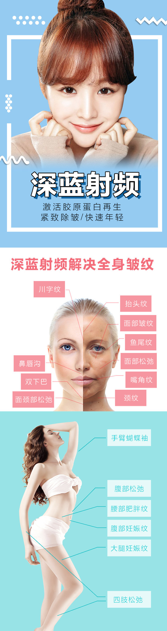 【深蓝射频】【v脸爆款】 以色列飞顿深蓝紧肤 胶原紧致 抗衰 立竿见