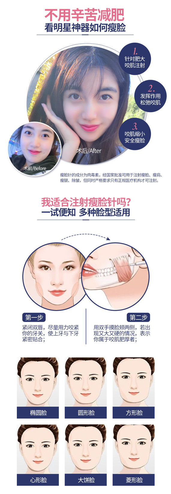 保妥适肉毒素 100单位 ,[美国进口botox瘦脸针]支持正品验证 快速安全