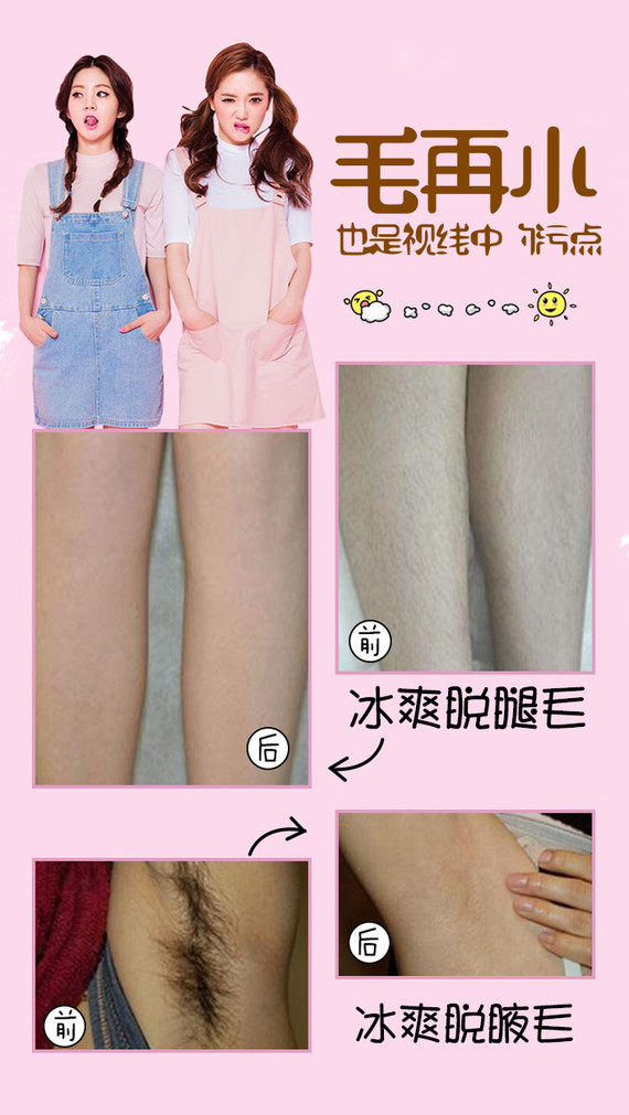 【激光脱毛】脱唇毛 1次 ,【冰点脱毛】单人单部位1次