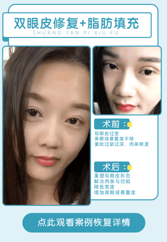 护肤品 化妆品 面膜 570_823 竖版 竖屏 gif 动态图 动图
