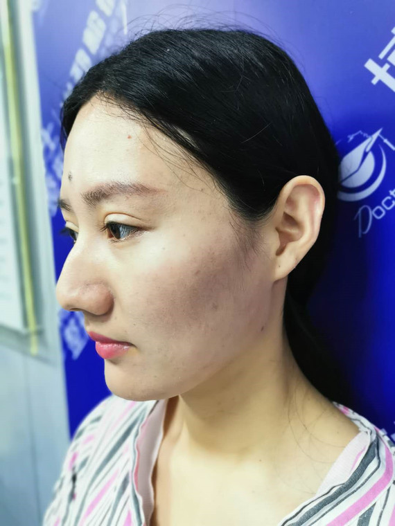 3,鼻尖呈现向下弯曲下垂,外形如同鹰勾鼻.