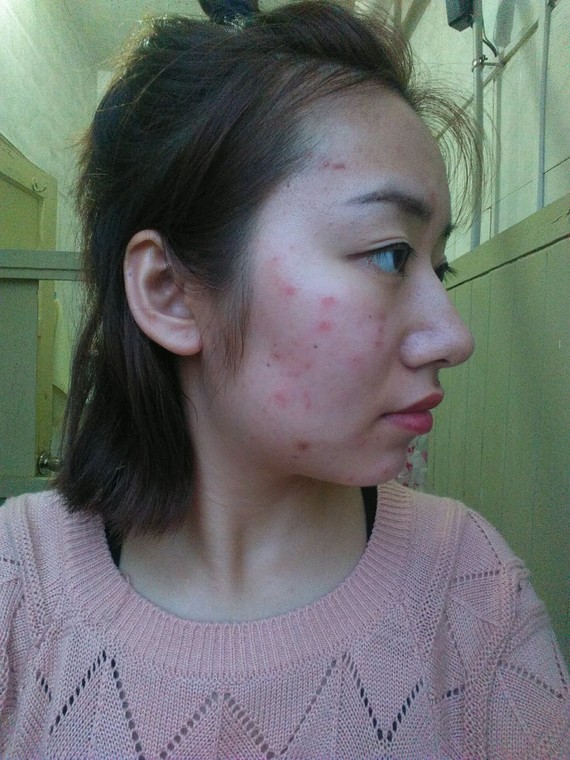 一直以来都左右脸很不对称,可能是平时喜欢用