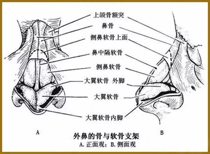 根据骨椎偏斜的程度用骨凿或骨锯由梨状孔缘向上,切断上颌骨额突及