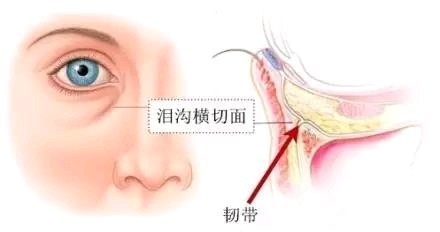 很多人会因为眼袋的存在,而忽视泪沟的问题,所以整个下眼睑的处理,只