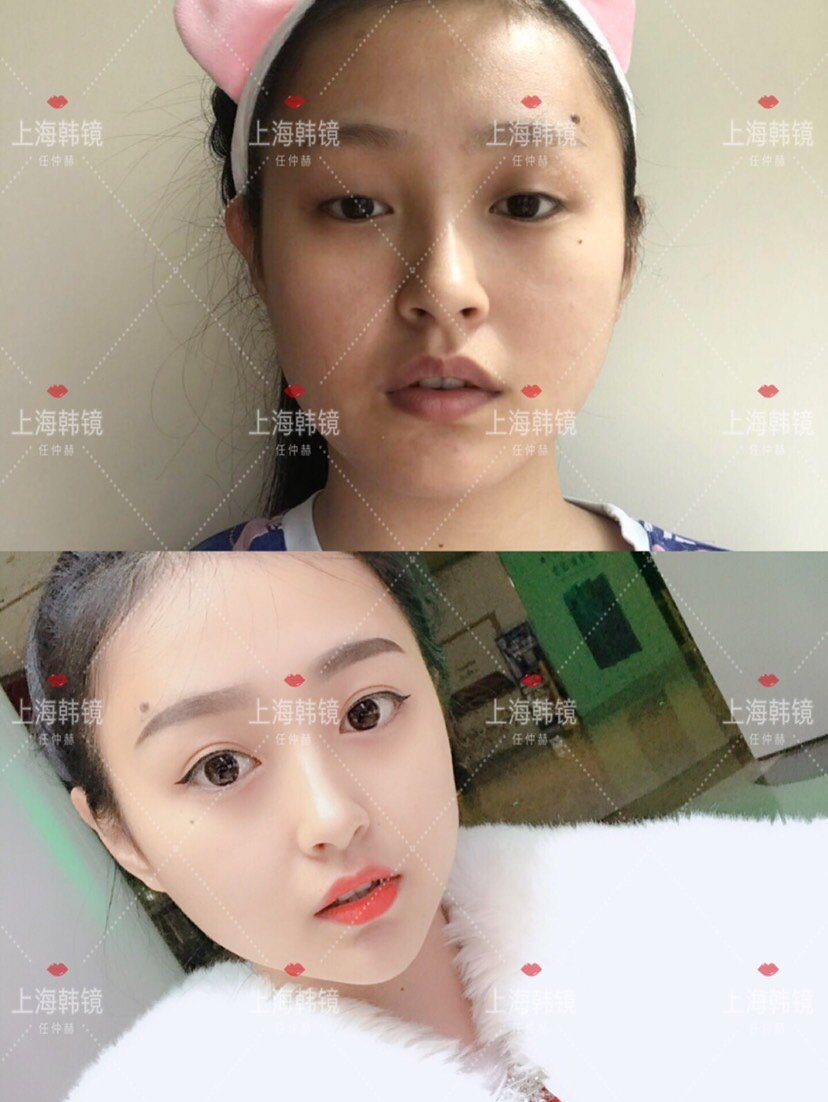 眼综合一般包括哪些项目呢?