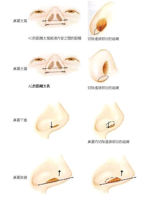 好看的鼻子形状应该是鼻宽度占我们脸的宽的1/5左右,从下面看时成正