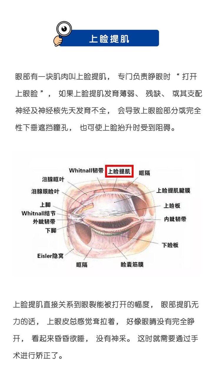 去咨询双眼皮手术医生建议我双眼皮和上睑提肌一起做那么什么是上睑提