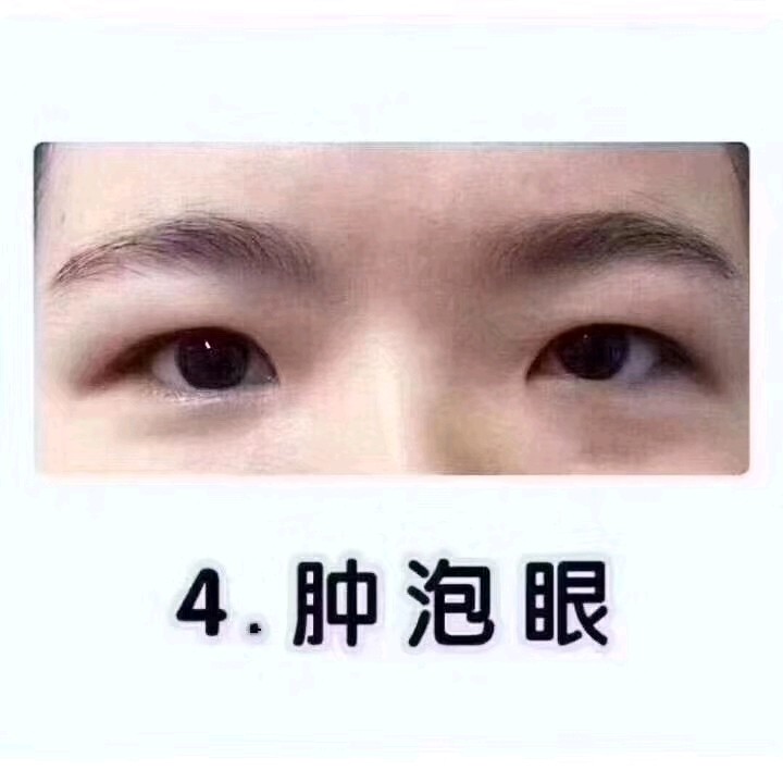 5,三角眼