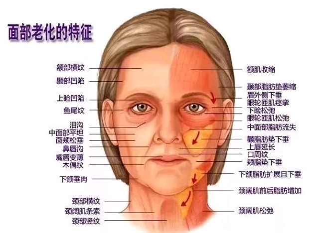 面部下垂怎么办,脸部下垂怎样提升,面部提升管用吗?