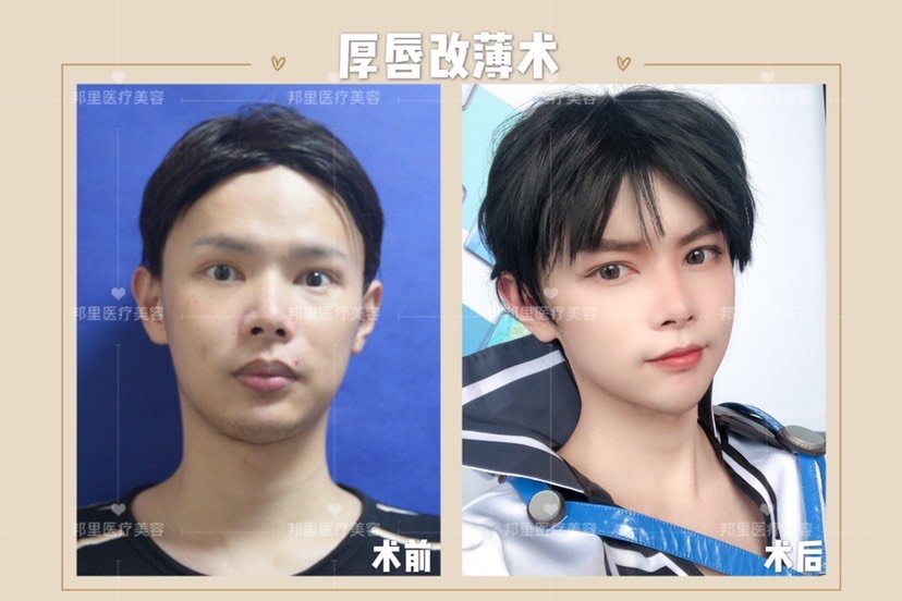 男生什么嘴唇好看啊