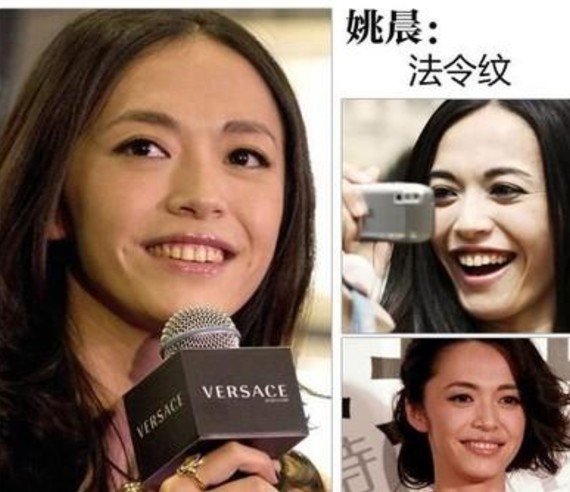 很多情况会导致法令纹的出现,其中鼻型和嘴型对于法令纹年轻女人的