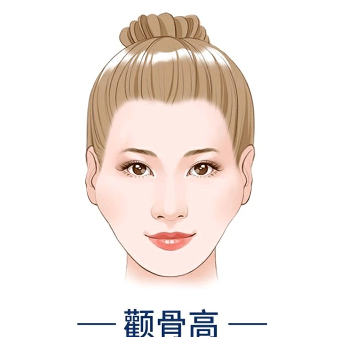 什么是颧骨内推