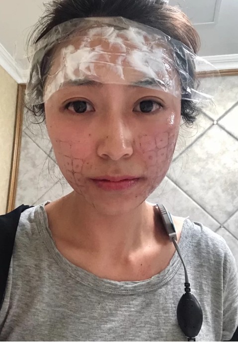 热玛吉