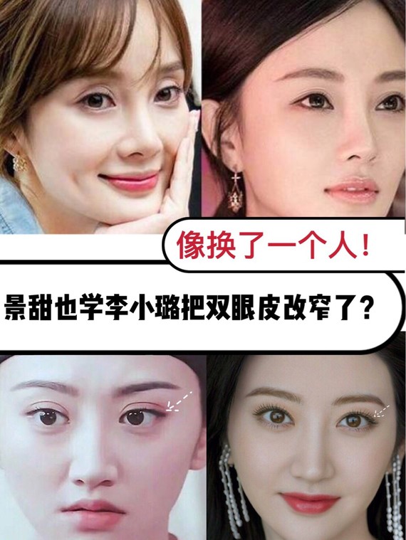 景甜也学李小璐把双眼皮修窄了?像换了个人!