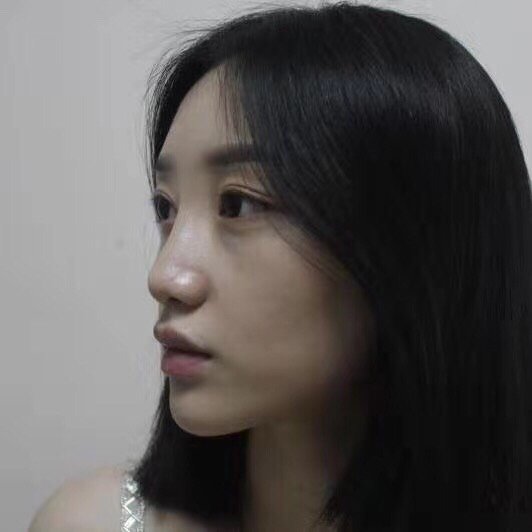 回眸一笑吓跑男神的最丑侧颜特征?看看你有没有?