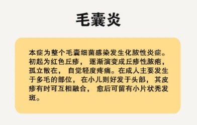 植发后毛囊炎的原因植发后毛囊炎一般是出现在植发1-2个月的时候.