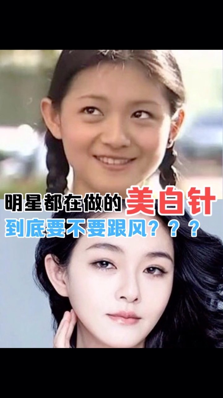 很多明星都在做的美白注射要不要跟风