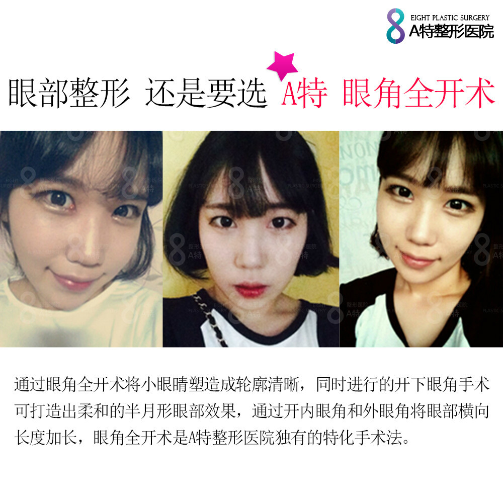 作为韩国整形热门手术之一的眼部整形,对于它的多样性,复杂性还