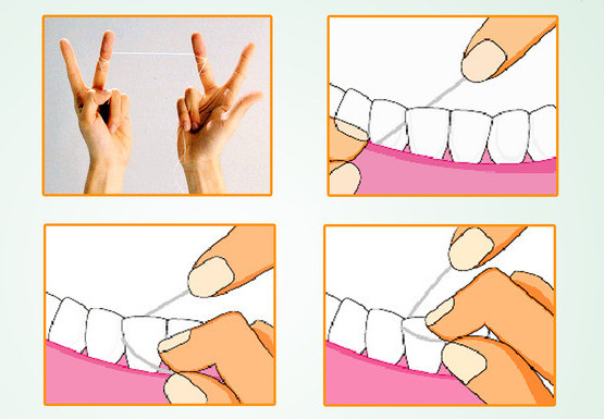 今天龙博士教你牙线与牙缝刷怎么用