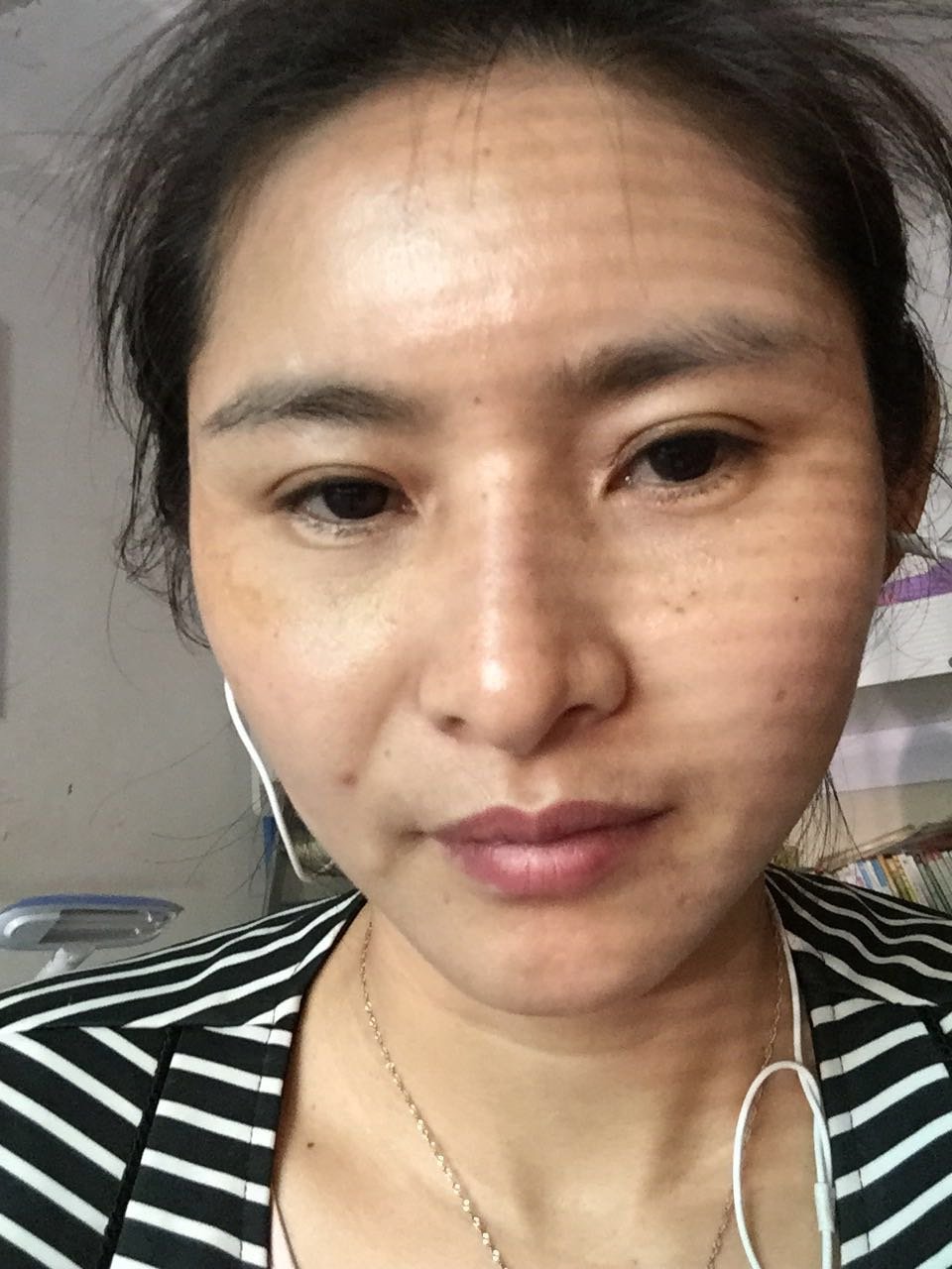 瘦脸针真是遭罪啊,这一周来嘴巴酸的,吃起东西来都没劲,现在终于出