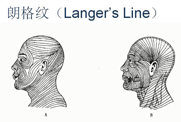 朗格纹(langer"s line)存在于皮肤纹理当中,是皮下组织之间的连接线