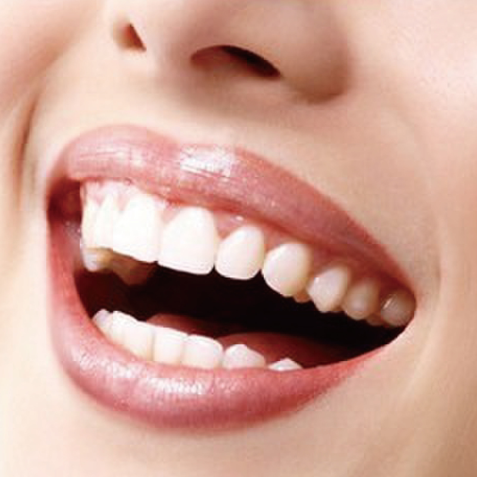 牙齒美容 | 桃園植牙推薦-全口重建首選-四季牙醫診所
