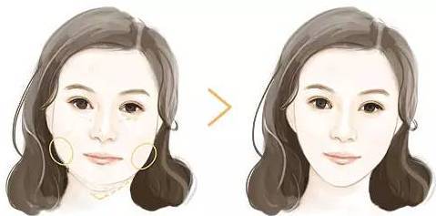 【保妥适肉毒素100单位】【宋亚医疗美容BOTOX瘦脸针一支】从U到V一_圈子-新氧美容整形