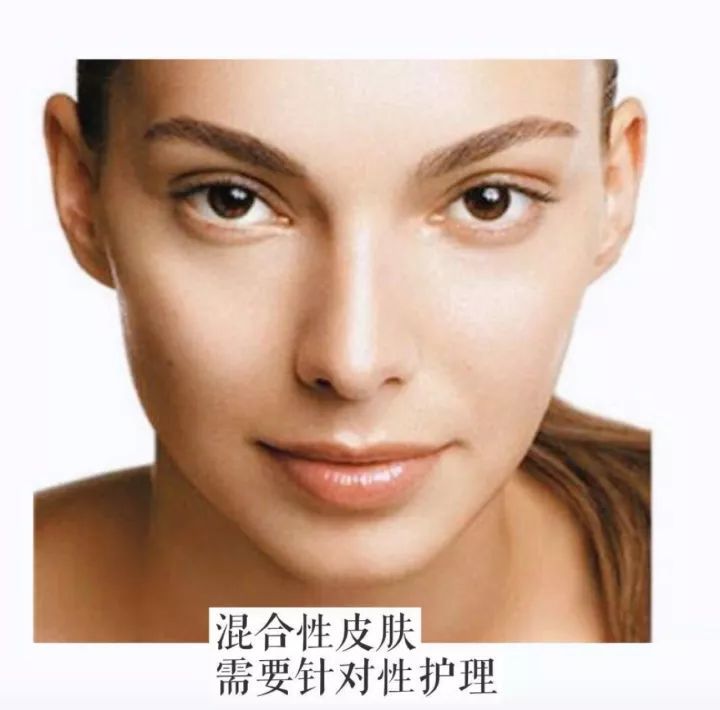 这是混合性皮肤.
