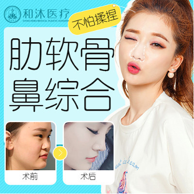 【鼻部多项【整形协会秘书长主刀】进口韩式生科假体 耳软骨 鼻头