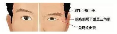 这几种眼型的小伙伴可以做个"双眼皮"抢救一下了