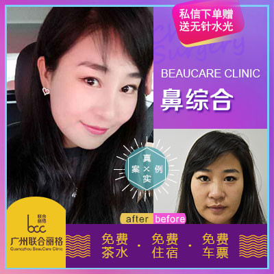 氧气xsv2m鼻综合第230天美丽日记第38页-新氧美容整形