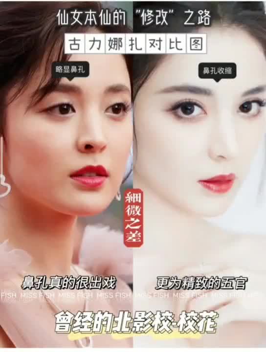 仙女本仙古力娜扎的"do脸"之路,原本的鼻子鼻孔特