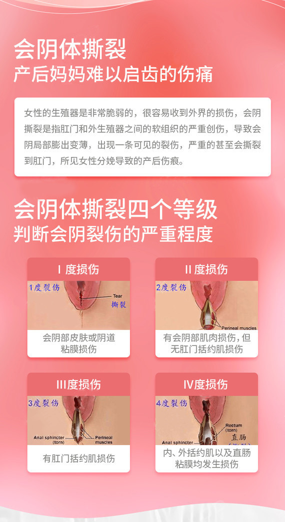分娩修复 产后私密修复 改善松弛 私密紧致