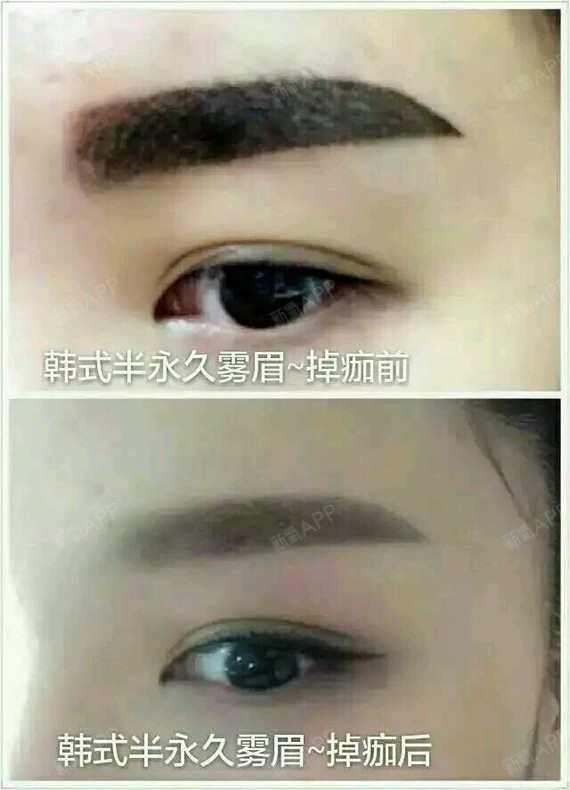 刚做的美瞳线,半永久雾眉坐等掉痂吧