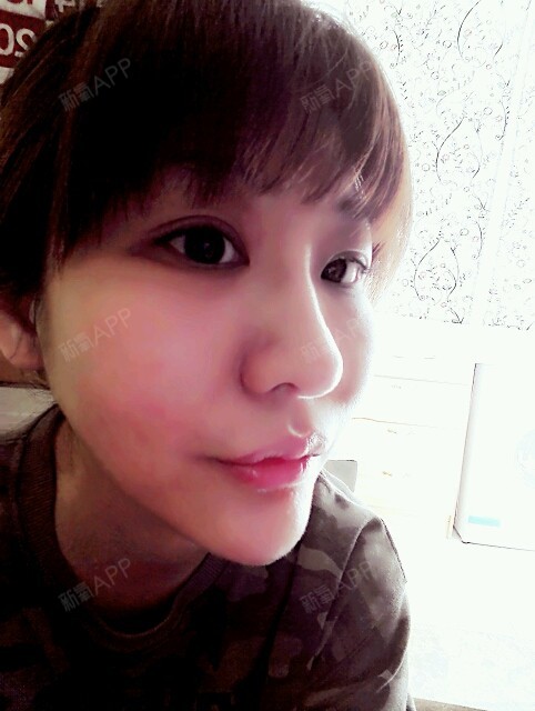 ... | 鼻部 | 鼻头整形 | 肉毒素缩鼻头 | 术后当自强