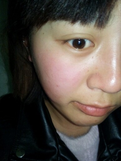 颌面矫正手术是个笼统的说法,具体分为上颌前