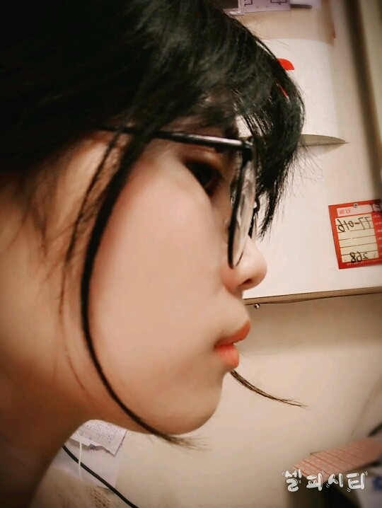 颌面矫正手术是个笼统的说法,具体分为上颌前