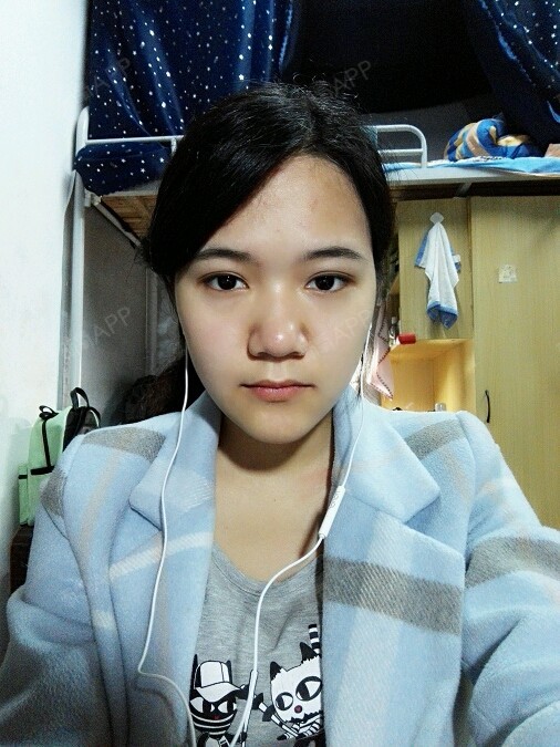想整鼻子鼻头大鼻翼宽请问有什么项目推荐的么大概什么_圈子-新氧美容