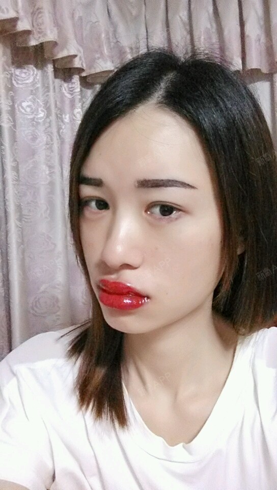 后面几张照片是我擦了唇部修复膏之后…所以闪闪发光的_圈子-新氧美容