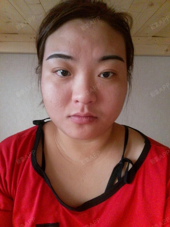 北京金燕子日记招募星之眼25岁客服想做光纤溶脂v脸术想做女神,想要