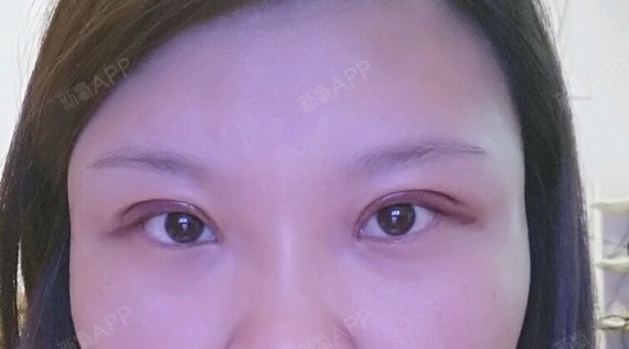 希望快点恢复,煎熬的期待中